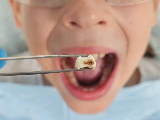 Best Pediatric Emergency Dentist in Livermore, CA