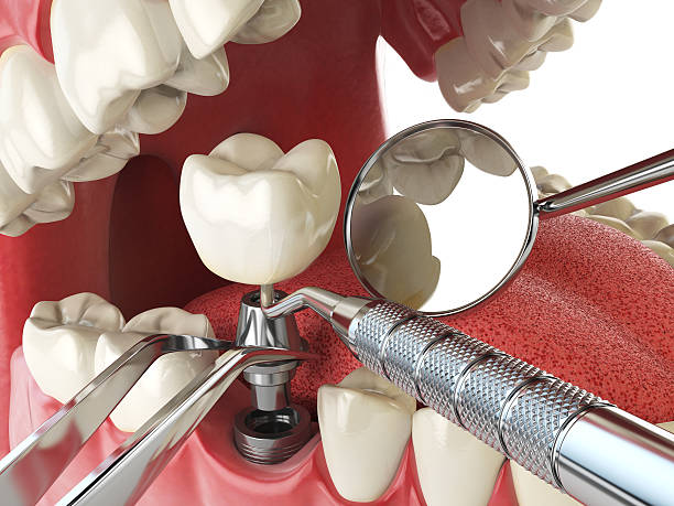 Best Emergency Orthodontic Repairs in Livermore, CA