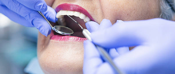 Best Emergency Broken Tooth Repair in Livermore, CA